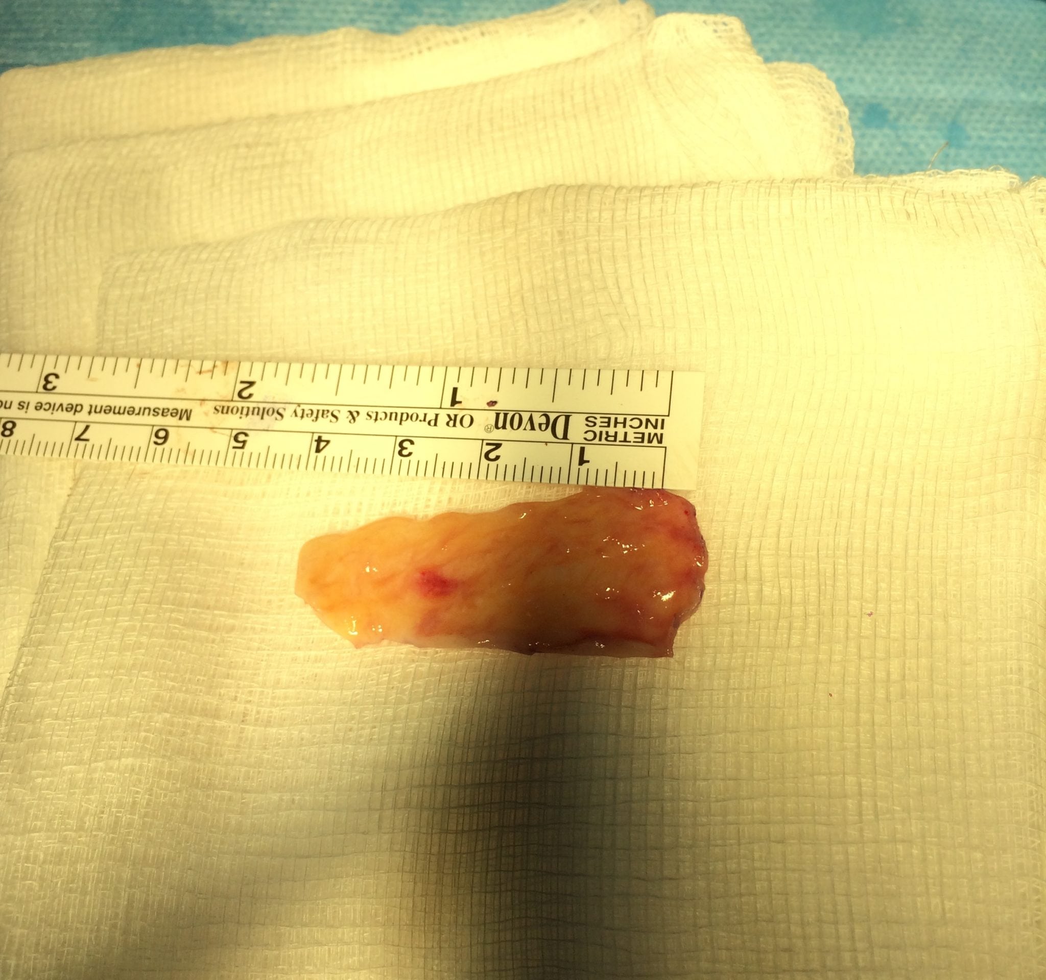 lambou mucoasa bucala