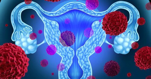 Sindromul de șoc toxic menstrual