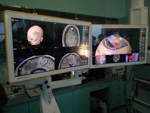 intervenții neurochirurgicale asistate SCJU Cluj Napoca 2